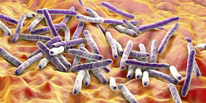 Examples of Bacterial Diseases