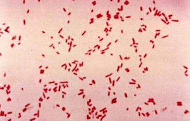 Gram-Negative Bacteria