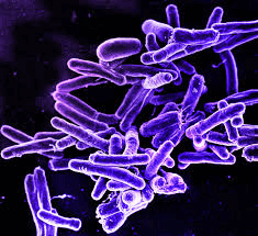 Gram Positive Bacteria