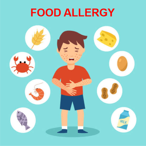 Allergy Definition