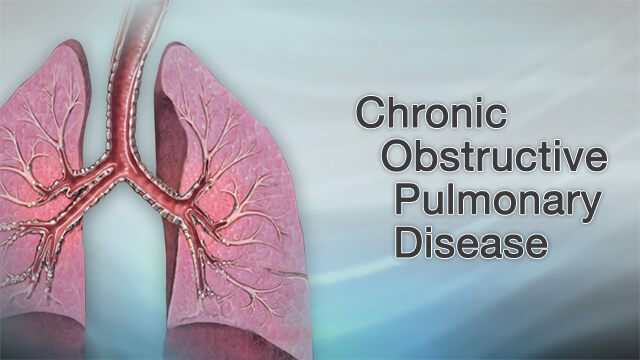 COPD Definition