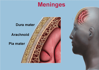 Meningitis Definition
