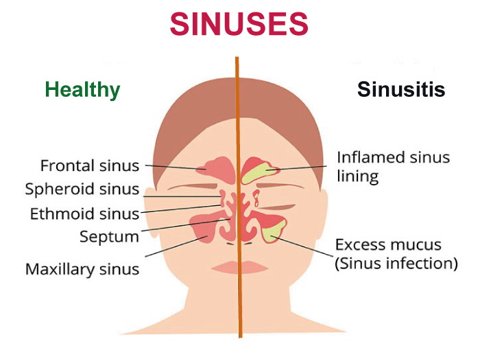 Sinus Definition