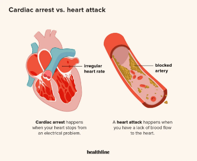 Difference between Heart attack and Cardiac Arrest