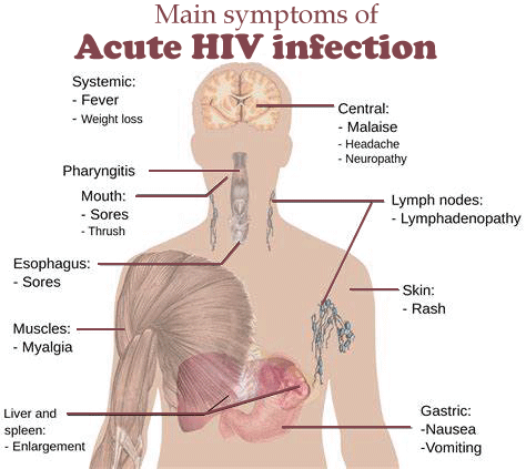 Difference between HIV and AIDS