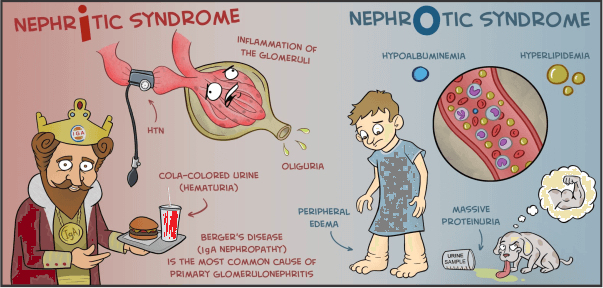 Difference between Nephrotic and Nephritic Syndrome