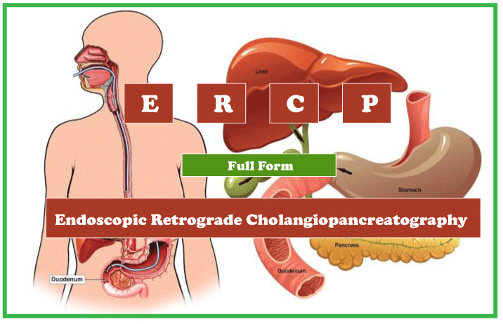 ERCP Full Form