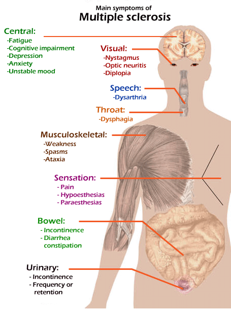  MS Full Form In Medical Multiple Sclerosis JavaTpoint