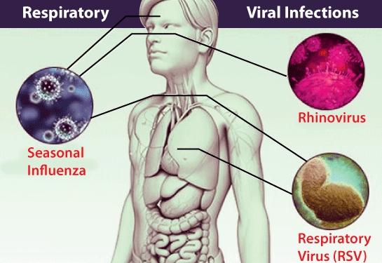 List of Viral Diseases in Humans