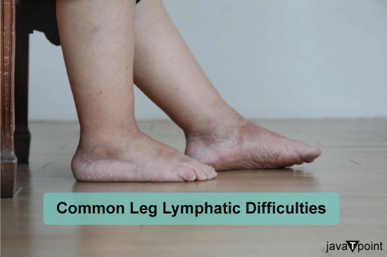 How to Improve Lymphatic Drainage in the Legs - Javatpoint