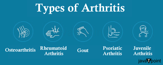 How to Prevent Arthritis - Javatpoint