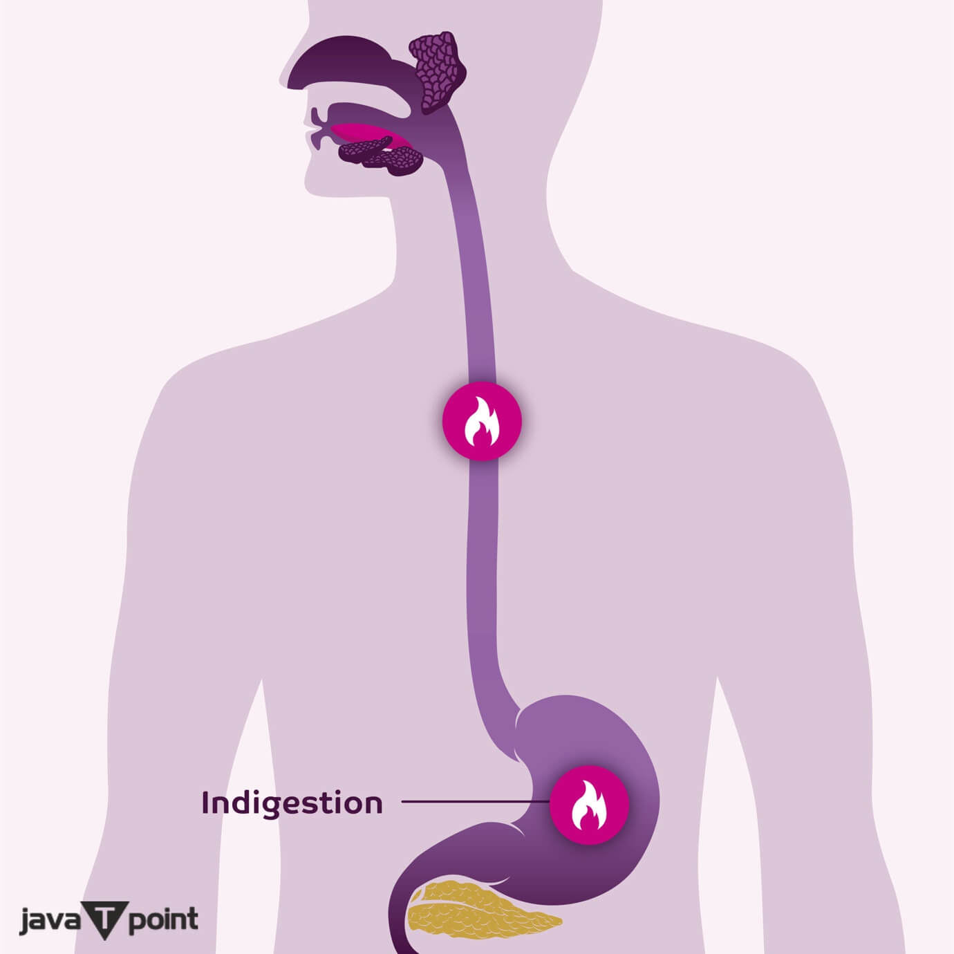 How to Treat Indigestion at Home - Javatpoint